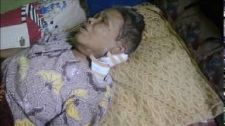 Perembuan Buta dan Lumpuh Penderita Di